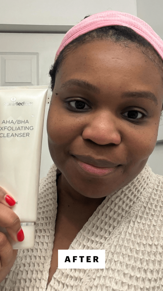 Cruel after applying the SkinMedica AHABHA Exfoliating Cleanser